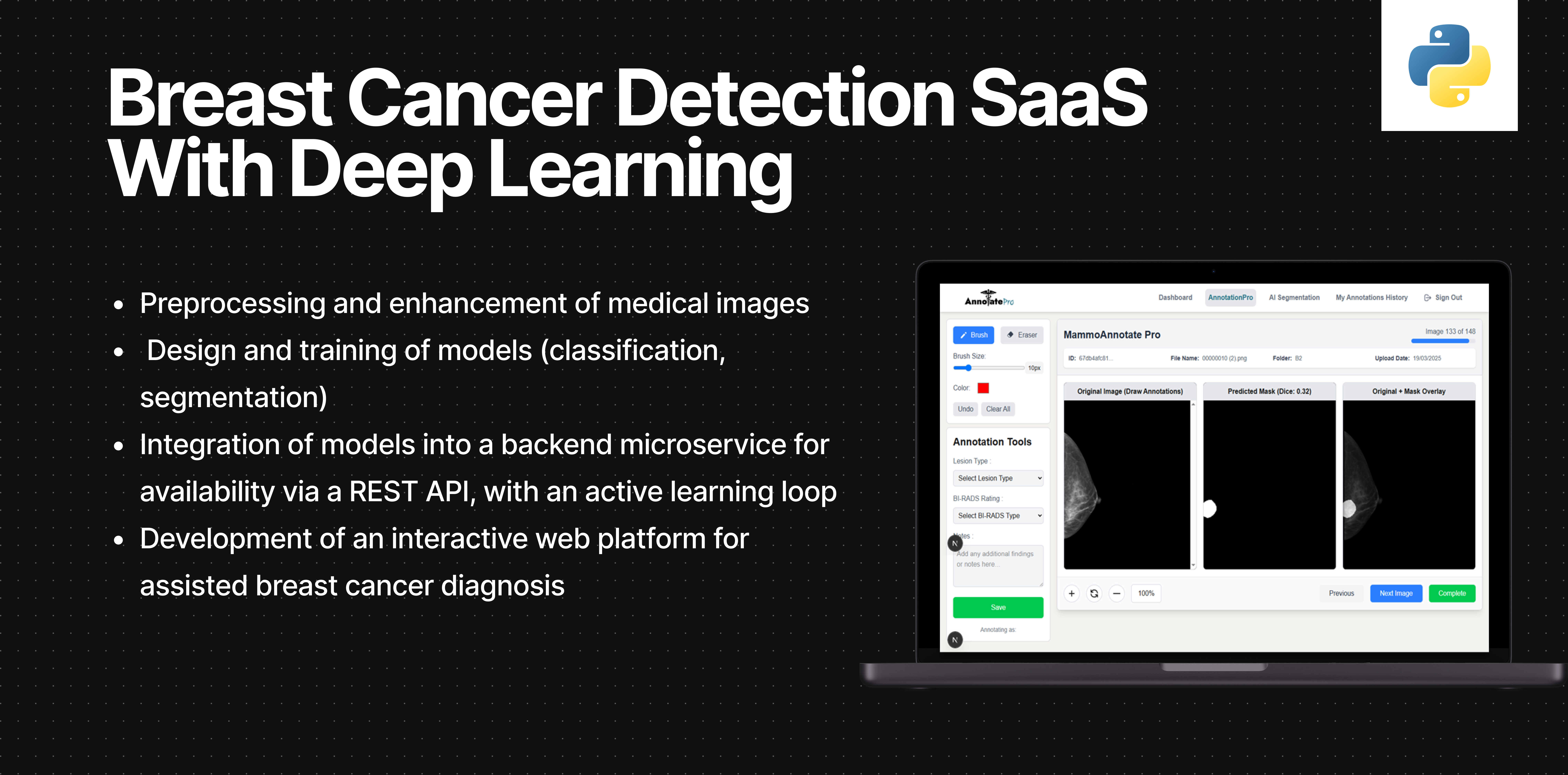 Breast Cancer Detection SaaS using Deep Learning: